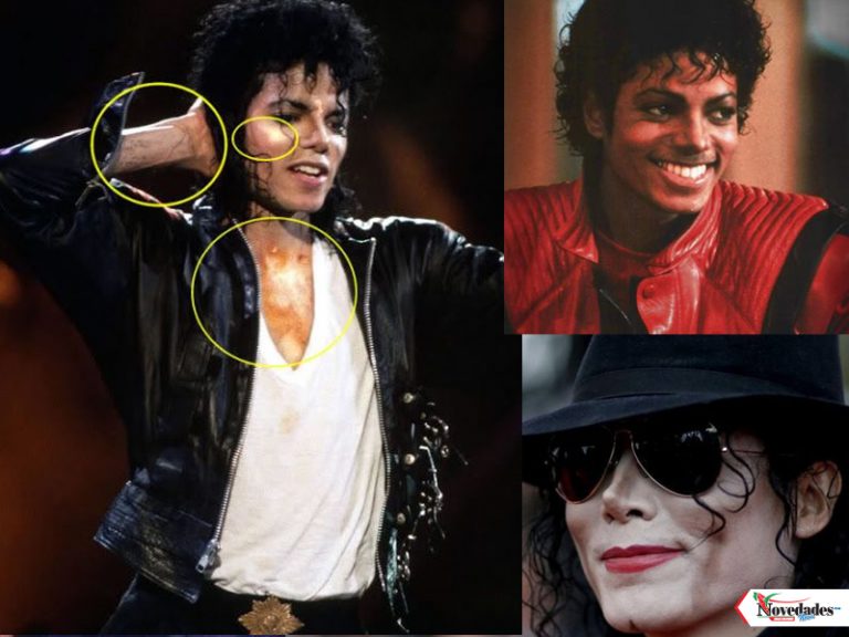 ¿Cómo le hizo Michael Jackson para hacerse de piel blanca? – Novedades News